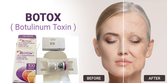100Units Allergan Botulinum Toxin Loại A Tiêm để loại bỏ nếp nhăn trên khuôn mặt