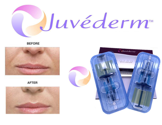 2x1ml Chất làm đầy da Juvederm liên kết chéo để làm đầy nếp nhăn trên khuôn mặt