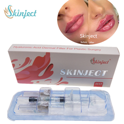 Skinject Deep Hyaluronic Acid Dermal 2ml Chất làm đầy môi có thể tiêm