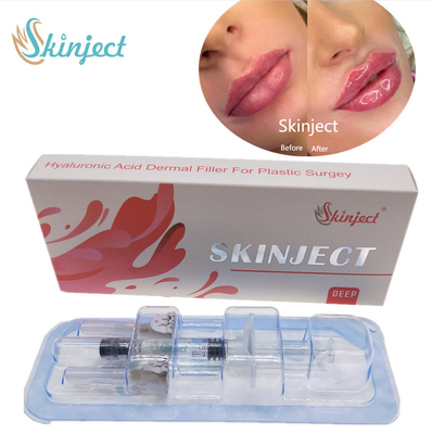 Tiêm Skinject Deep HA Dermal 2ml Chất làm đầy Môi Cheek Chin Nasolabial Fold