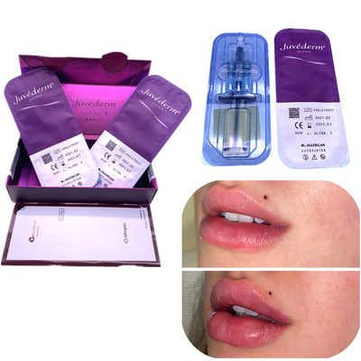 Tiêm Ha Filler Juvederm Nâng Cơ Môi 2x1ml Xóa Nếp Nhăn