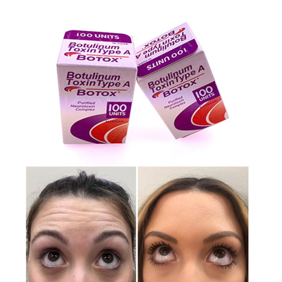 100 IU Allergan  Botulinum Toxin Phiên bản tiếng Anh