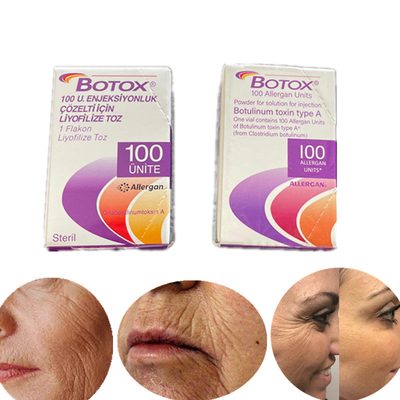 Phiên bản tiếng Anh Loại A Botulinum Toxin 100 Iu Allergan  cho nếp nhăn
