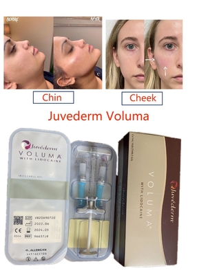 Juvederm Voluma Chất làm đầy axit hyaluronic liên kết chéo cho khuôn mặt lâu dài Thuốc tiêm tinh khiết