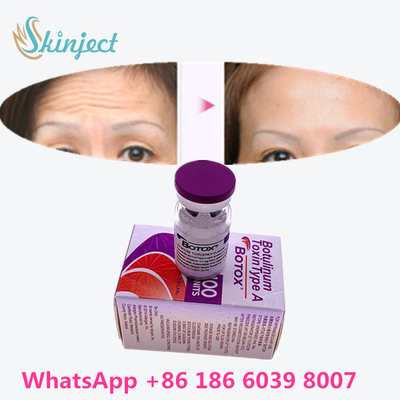 Botulinum Toxin  Xóa nếp nhăn 100u Allergan 100 đơn vị để tiêm nâng cơ mặt