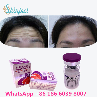 Botulinum Toxin  Xóa nếp nhăn 100u Allergan 100 đơn vị để tiêm nâng cơ mặt