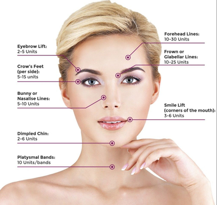 Đường trán Chống nhăn Botulax  Chất làm đầy da Botulinum để nâng cơ mặt