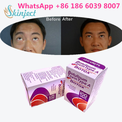 Botulinum Toxin Allergan  1x100iu cho nếp nhăn trên khuôn mặt