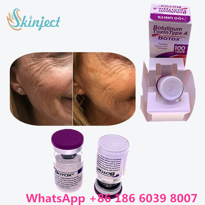 Botulinum Toxin Allergan  Type A 100 đơn vị Đóng gói 1 Lọ / Hộp