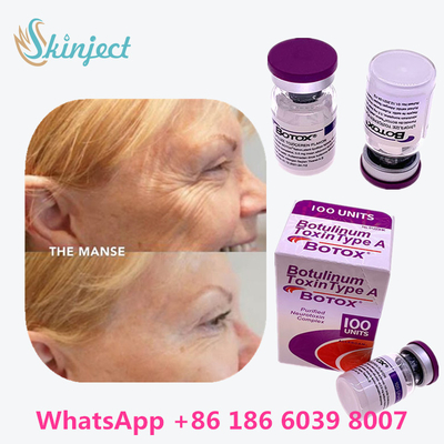 Botulinum Toxin Allergan  Type A 100 đơn vị Đóng gói 1 Lọ / Hộp