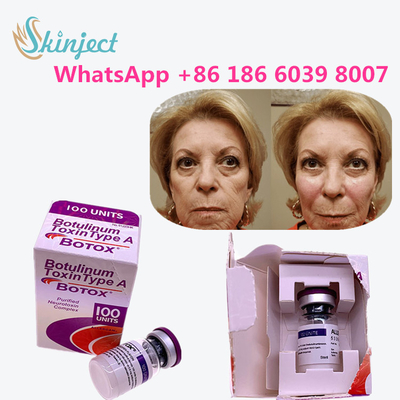 allergan botulinum toxin Sản phẩm chống lão hóa Loại A Toxin Chống nhăn
