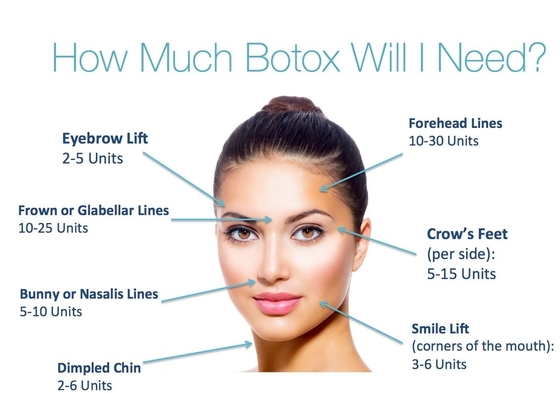 100 Iu Sản phẩm chống nhăn Hàn Quốc Botulinum Toxin  Type A