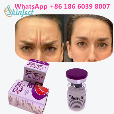 Allergan  Botulinum Toxin Type A cho các sản phẩm chống lão hóa da