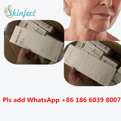Hyaluronic Acid Dermal Revolax Deep Filler 1ml để tiêm môi