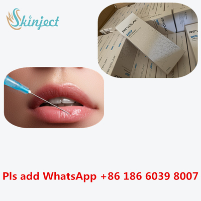 Chất làm đầy da dạng tiêm Revolax 24 Mg / Ml HA Hyaluronic Acid Tiêm