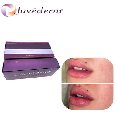 Juvederm axit hyaluronic làm to môi chất lấp da nâng mũi chất lấp kéo dài cho khuôn mặt
