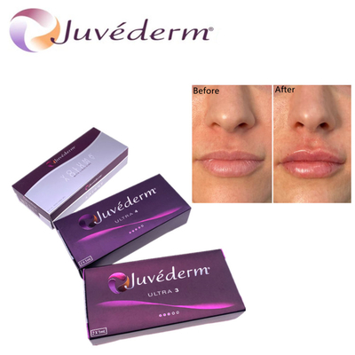 Hyluronic Acid Dermal Filler Premium Juvederm HA Face Filler Ultra3 Ultra4 Voluma Để trẻ hóa khuôn mặt