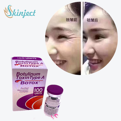 100 Đơn vị Độc tố Botulinum Loại A 2 - 8°C Nhiệt độ Bảo quản