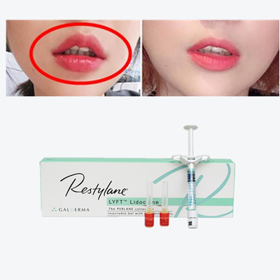 Vital  Perlane Cross Linked Dermal Filler Hyaluronic Acid Lyft Bộ lấp da
