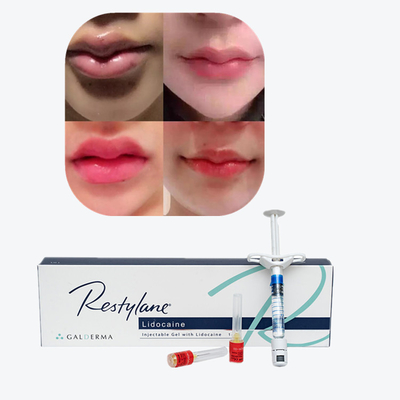 Juvederm Cross Linked Injectable Dermal Filler cho môi