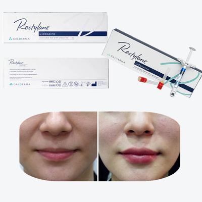 Cross Linked Hyaluronic Acid Dermal Filler Cho Việc Tăng Nông