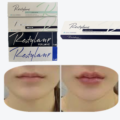 Cross Linked Hyaluronic Acid Dermal Filler Cho Việc Tăng Nông