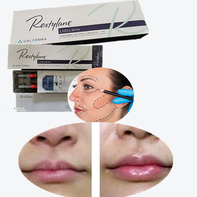 Bộ sạc da mũi tiêm môi sản phẩm gốc Hàn Quốc Authentic Sodium Hyaluronate Lip Filler