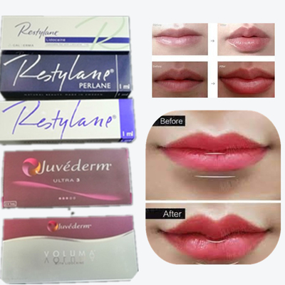 Bộ sạc da mũi tiêm môi sản phẩm gốc Hàn Quốc Authentic Sodium Hyaluronate Lip Filler