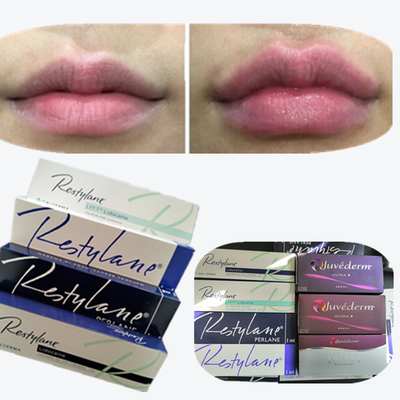 2*1ml/Box Hyaluronic Acid Dermal Filler cho tăng môi