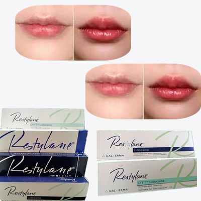 2 * 1ml / Box Cross Linked Dermal Filler cho tăng môi