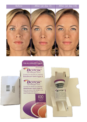 Tiêm Allergan Botulinum Toxin 100IU Anti Rugs Dermal Filler