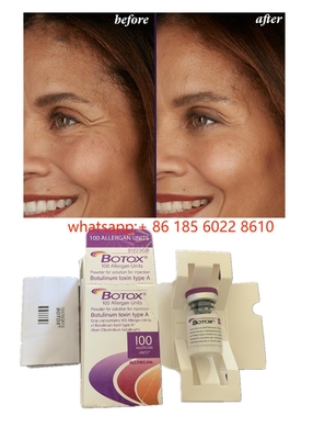Sản phẩm làm đẹp Allergan 100 đơn vị Botulinum Toxin  cho nếp nhăn mặt