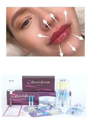 Juvederm' Hyaluronic Acid Dermal Filler Ultra3 Ultra4 Voluma Injection để làm đầy môi