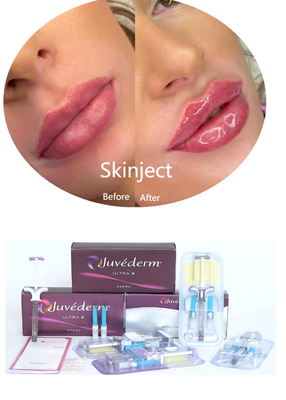 Juvederm Hyaluronic Acid Face Dermal Filler Tiêm 2*1ml Bao bì
