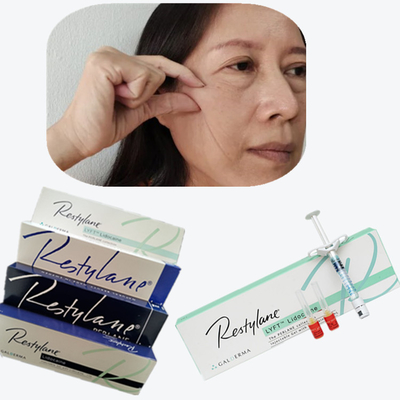 Cosmetic Cross Linked Dermal Filler HA Tiêm cho góc miệng