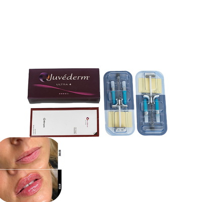 Juvederm Dermal Filler cho môi Tiêm chất lấp axit hyaluronic