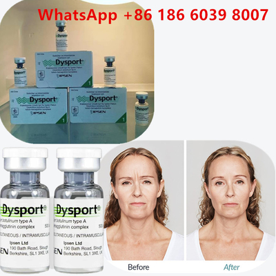 Botulinum Toxin Type A 100 đơn vị  tiêm cho nếp nhăn mặt