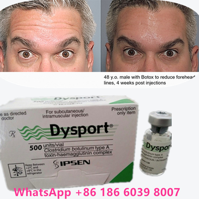 Botulinum Toxin 100 đơn vị BTX Tiêu dùng mỹ phẩm