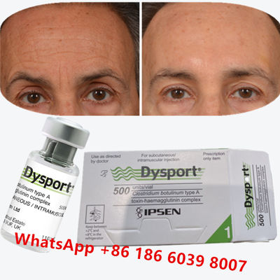 Botulinum Toxin Dysport Clostridium Botulinum Type A Đối với chân quạ