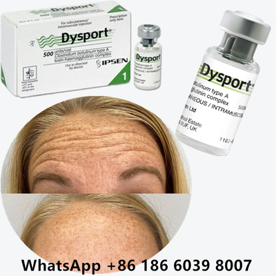 Botulinum Toxin Dysport 100u Clostridium Botulinum Type A Đối với các nếp nhăn trán