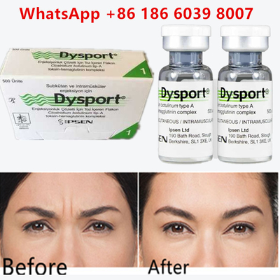 Botulinum Toxin Dysport 100u Clostridium Botulinum Type A Đối với các nếp nhăn trán