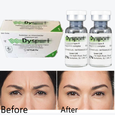 Botulinum Toxin Dysport Bột chống nếp nhăn Bột đông khô cho các đường nhăn
