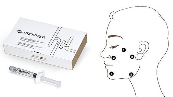 Chống lão hóa và loại bỏ nếp nhăn Profhilo H L 2ml axit hyaluronic với nồng độ 32mg/ml Ha