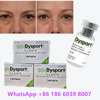 Botulinum Toxin Dysport Clostridium Botulinum Type A Đối với các nếp gấp mũi