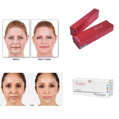 Chất làm đầy da tiêm Profhilo Ha nồng độ 32mg/ml chống lão hóa