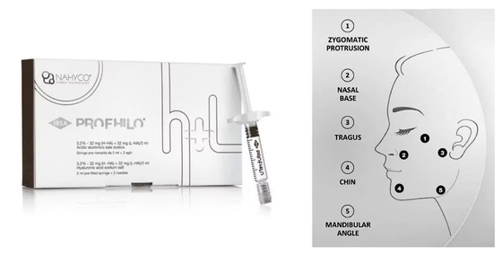 Nhìn tự nhiên Lift kim nâng 5 điểm Profhilo Dung da tiêm