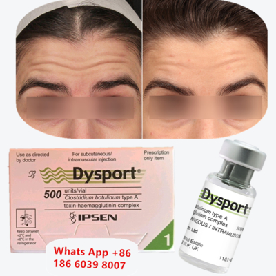 Tiêm Chống Nhăn Dysport Botulinum Toxin Type A cho Nếp Nhăn Quanh Miệng