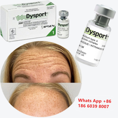 Tiêm Chống Nhăn Dysport Botulinum Toxin Type A cho Nếp Nhăn Quanh Miệng