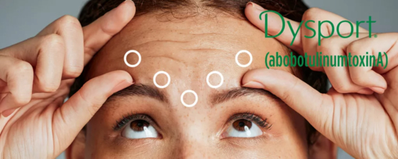 Dysport 500 Dùng để tiêm abobotulinumtoxinA Botox 500U
