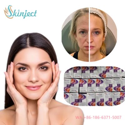 Allergan Botox Nobota 100u 200u để điều trị hiệu quả các đường nhăn mặt mũi tiêm độc tố botulinum